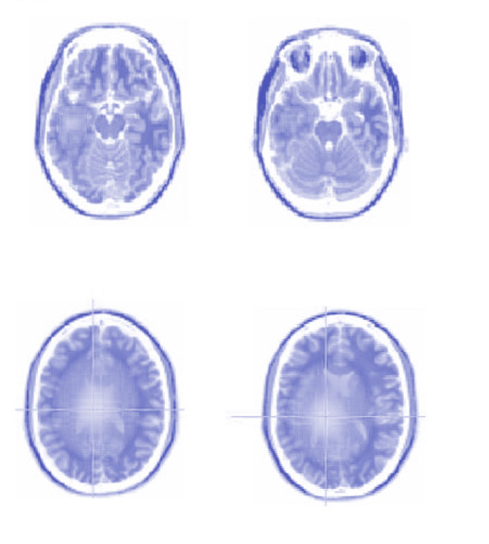 Image of "processing"