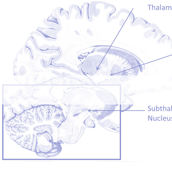 Image of "application"